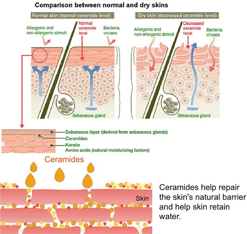 Ceramide-3 Ceramide-3